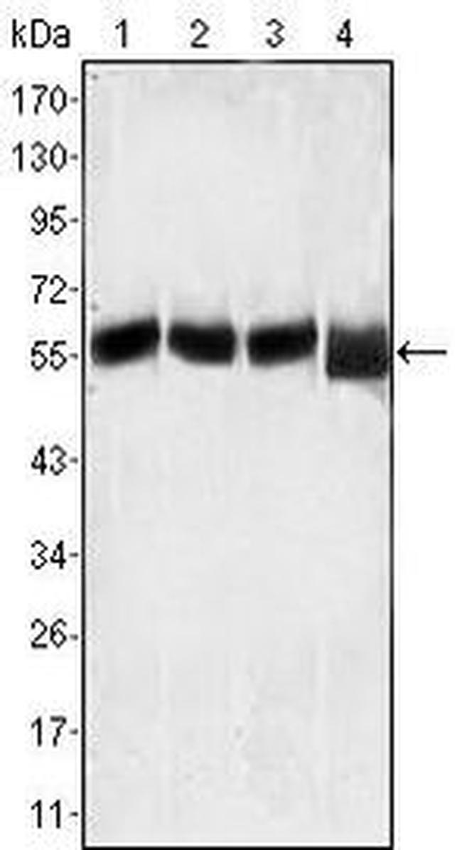 LCK Antibody in Western Blot (WB)