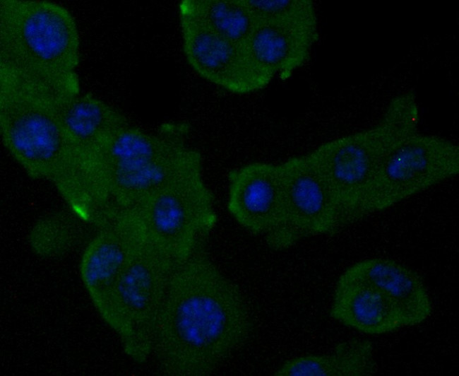 Alpha-2-macroglobulin Antibody in Immunocytochemistry (ICC/IF)