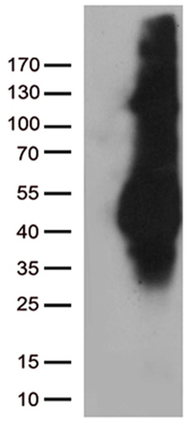 M6PR Antibody in Western Blot (WB)
