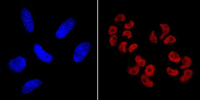 SOX2 Monoclonal Antibody (20G5), DyLight™ 650 (MA1-014-D650)