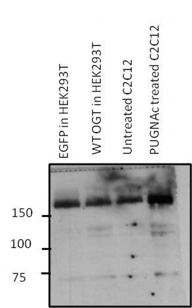 O-linked N-acetylglucosamine (O-GlcNAc) Antibody in Western Blot (WB)