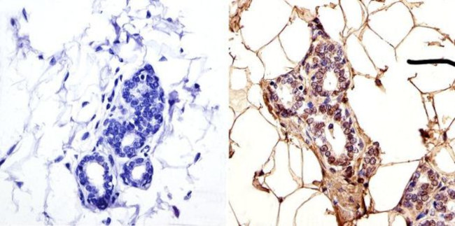 LAP1 Antibody in Immunohistochemistry (IHC)