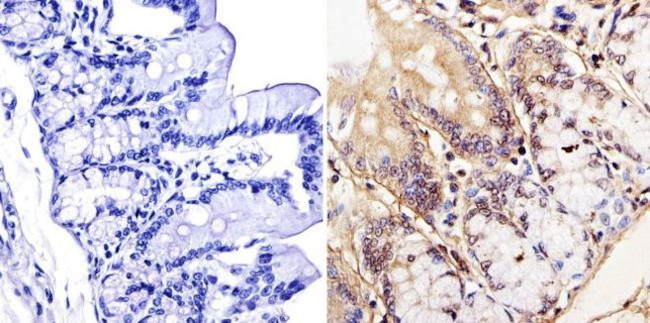 LAP1 Antibody in Immunohistochemistry (IHC)