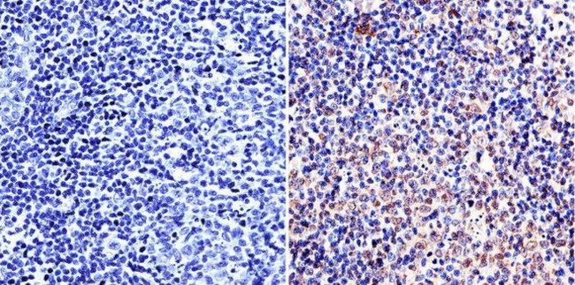 LAP1 Antibody in Immunohistochemistry (IHC)