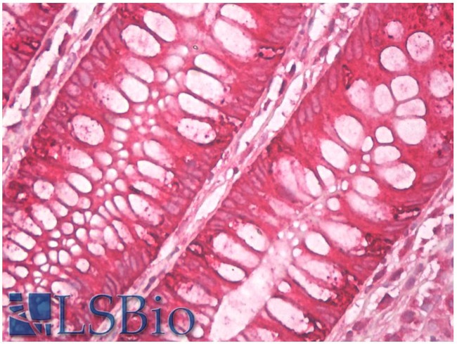 AGR2/AGR3 Antibody in Immunohistochemistry (Paraffin) (IHC (P))