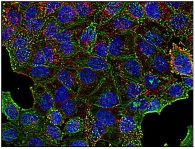 Clathrin Heavy Chain Antibody in Immunocytochemistry (ICC/IF)