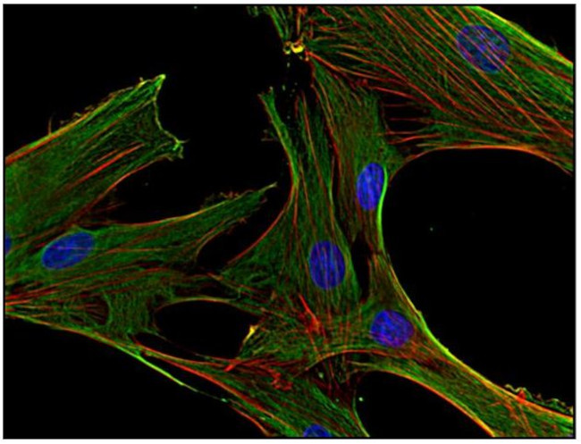 Clathrin Heavy Chain Antibody in Immunocytochemistry (ICC/IF)