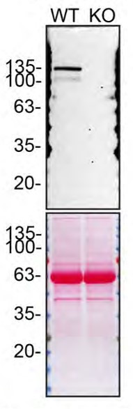 SHIP1 Antibody in Western Blot (WB)