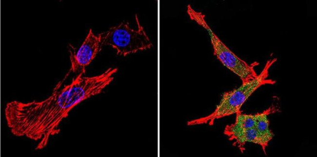 Nestin Antibody in Immunocytochemistry (ICC/IF)