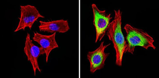 Cyclin B1 Antibody in Immunocytochemistry (ICC/IF)