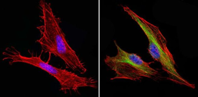 Cyclin B1 Antibody in Immunocytochemistry (ICC/IF)