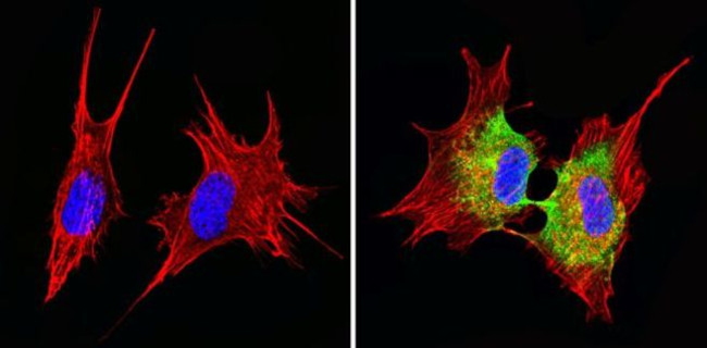 Cyclin B1 Antibody in Immunocytochemistry (ICC/IF)