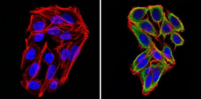 Cyclin B2 Antibody in Immunocytochemistry (ICC/IF)