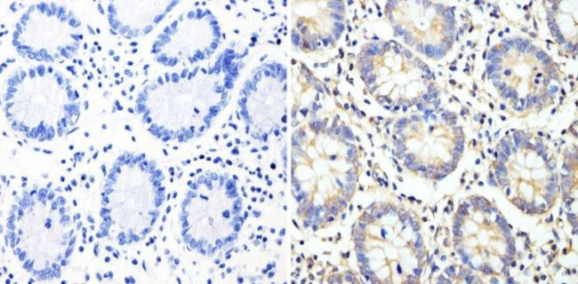 Cyclin B2 Antibody in Immunohistochemistry (Paraffin) (IHC (P))