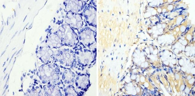 Cyclin B2 Antibody in Immunohistochemistry (Paraffin) (IHC (P))