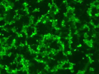 RPE65 Antibody in Immunocytochemistry (ICC/IF)