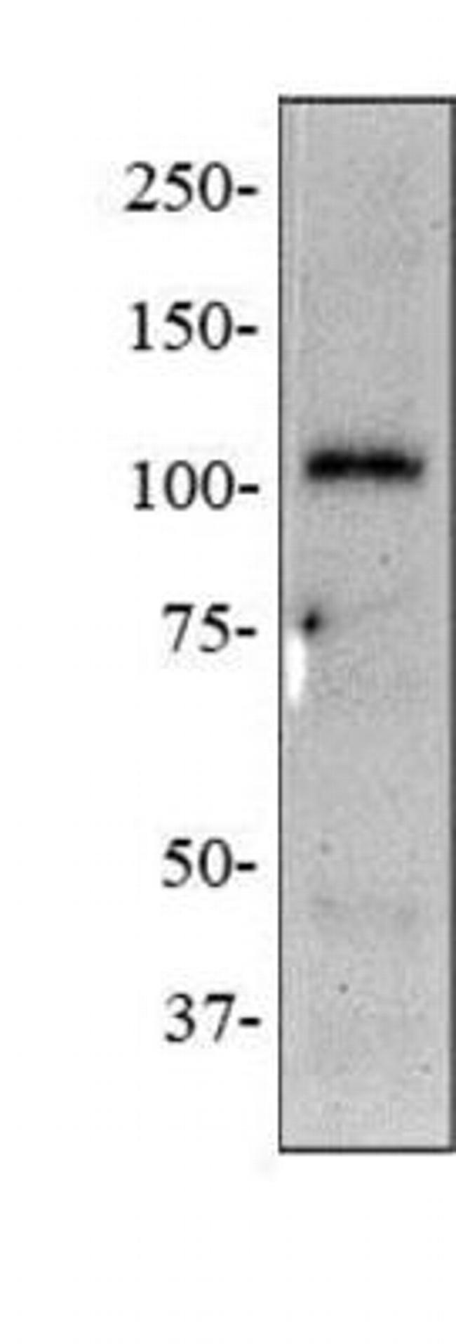 NOD2 Monoclonal Antibody (2D9) (MA1-16611)