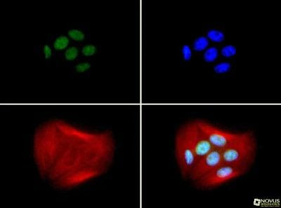 BRCA1 Antibody in Immunocytochemistry (ICC/IF)