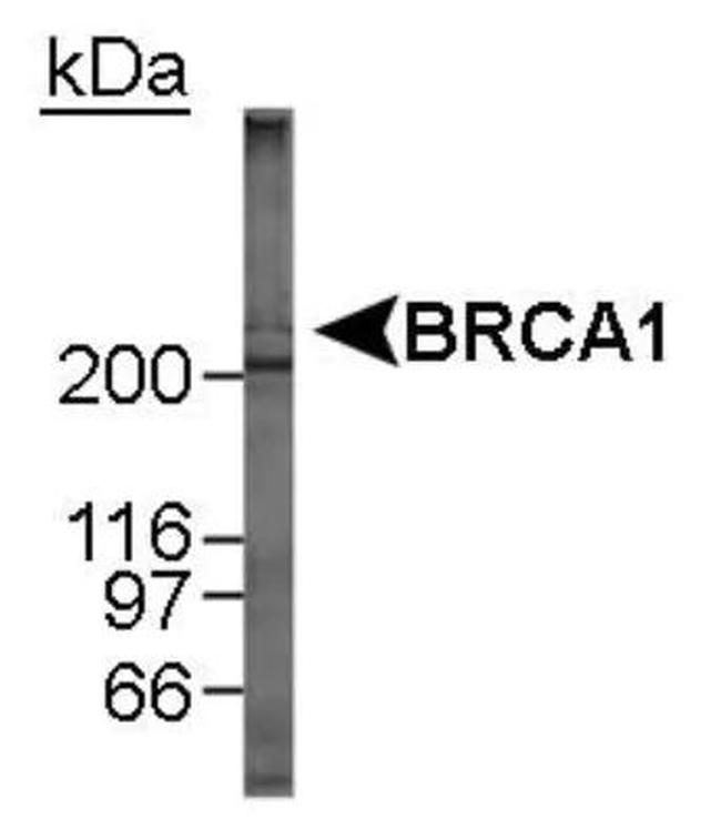 BRCA1 Antibody in Western Blot (WB)