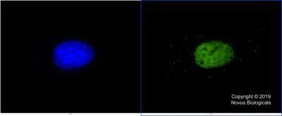 p300 Antibody in Immunocytochemistry (ICC/IF)