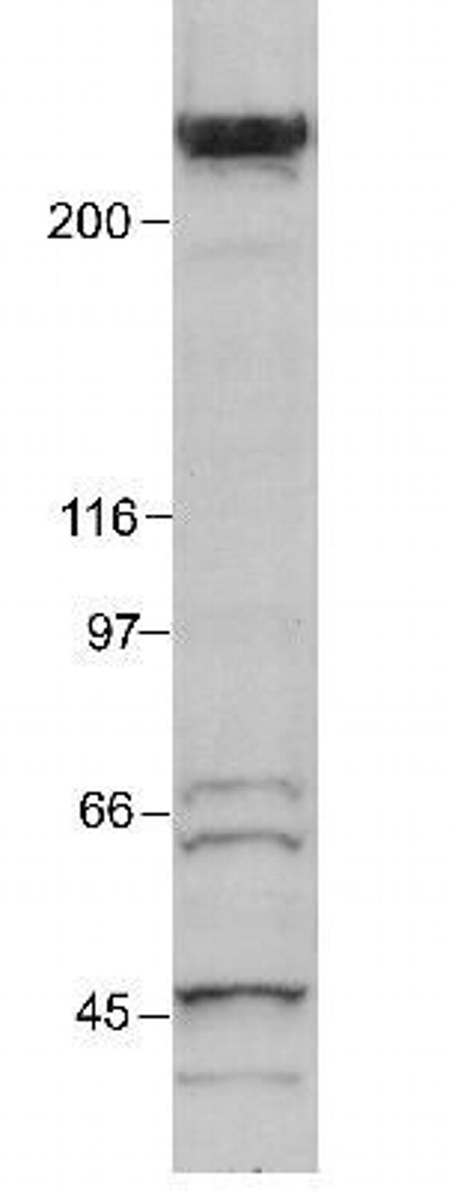 p300 Antibody in Western Blot (WB)