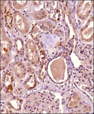 HIP1R Antibody in Immunohistochemistry (Paraffin) (IHC (P))