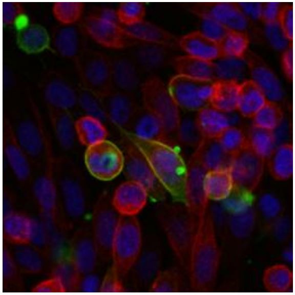 IL13RA1 Antibody in Immunocytochemistry (ICC/IF)