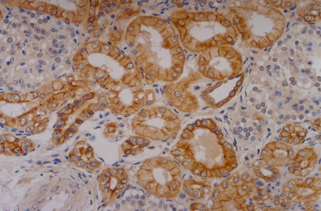 Cytokeratin 18 Antibody in Immunohistochemistry (Paraffin) (IHC (P))