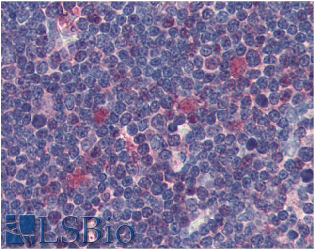 CDK1 Antibody in Immunohistochemistry (Paraffin) (IHC (P))