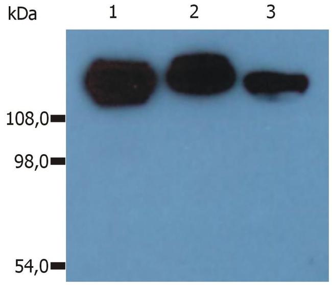 ITGB1 Antibody in Western Blot (WB)