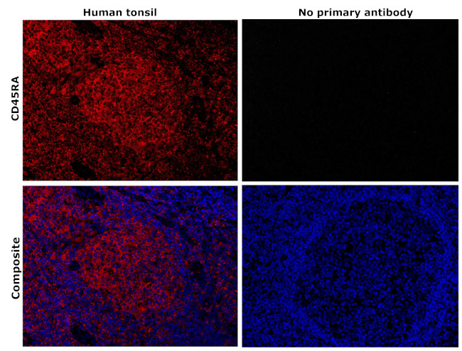 Long-Term Programming of Antigen-Specific Immunity from Gene Expression  Signatures in the PBMC of Rhesus Macaques Immunized with an SIV DNA Vaccine