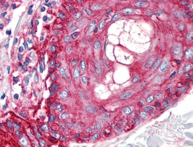 CD59 Antibody in Immunohistochemistry (Paraffin) (IHC (P))