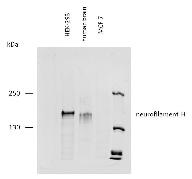 NF-H Antibody in Western Blot (WB)