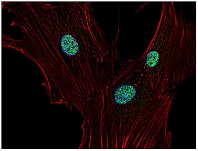 p21 Antibody in Immunocytochemistry (ICC/IF)