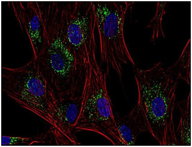 CD63 Antibody in Immunocytochemistry (ICC/IF)