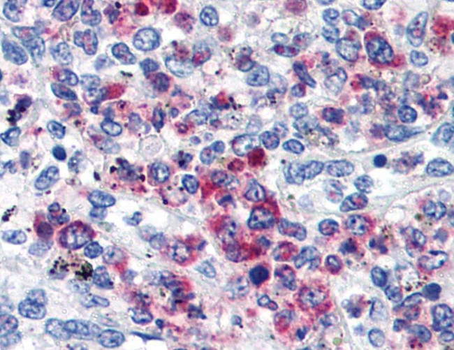 CD63 Antibody in Immunohistochemistry (Paraffin) (IHC (P))