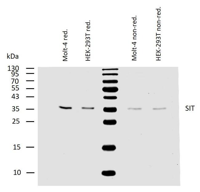 SIT Antibody in Western Blot (WB)