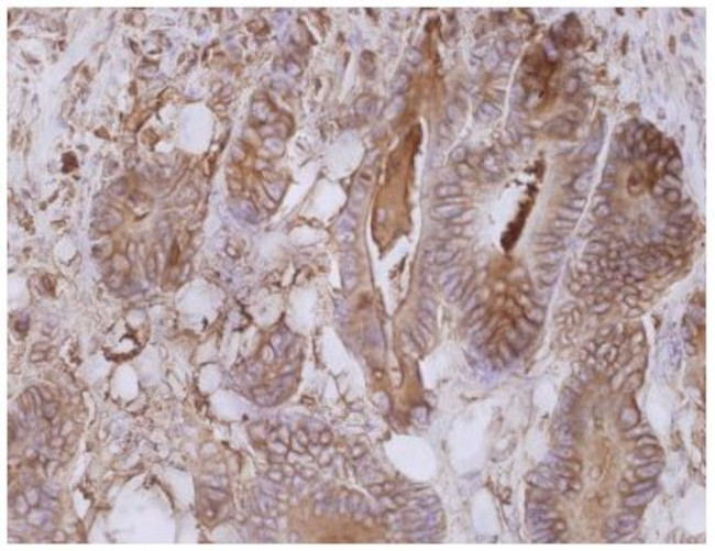 CEA Antibody in Immunohistochemistry (Paraffin) (IHC (P))