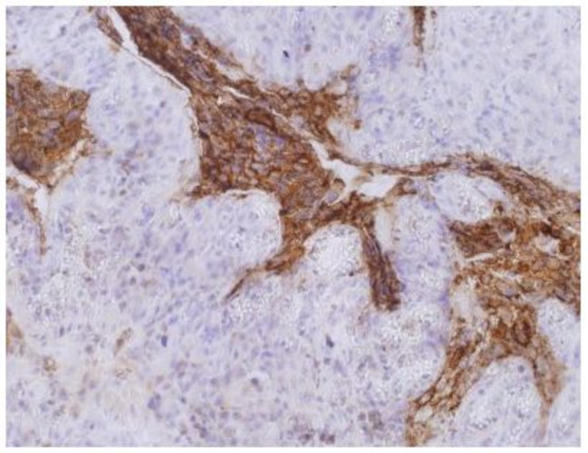 CEA Antibody in Immunohistochemistry (Paraffin) (IHC (P))