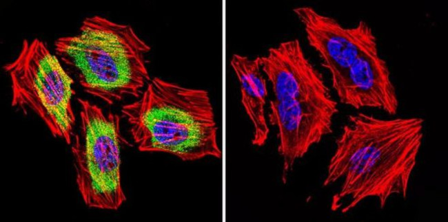 THRA/THRB Antibody in Immunocytochemistry (ICC/IF)