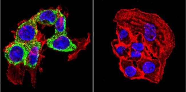 THRA/THRB Antibody in Immunocytochemistry (ICC/IF)