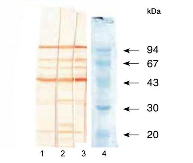 Bacillus anthracis Protective Antigen Antibody in Western Blot (WB)