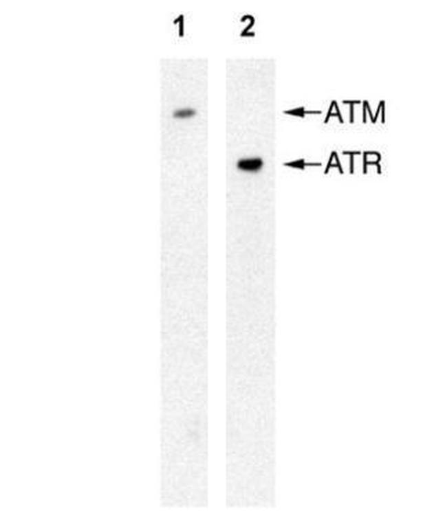 ATR Monoclonal Antibody (2B5)