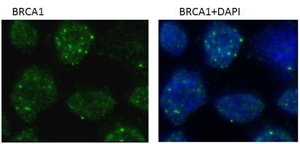 BRCA1 Antibody in Immunocytochemistry (ICC/IF)