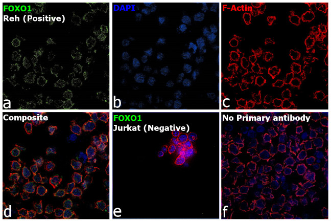 FOXO1 Antibody in Immunocytochemistry (ICC/IF)