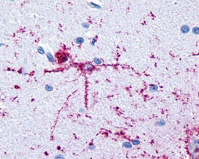 FOXO1 Antibody in Immunohistochemistry (IHC)