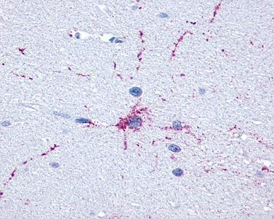 FOXO1 Antibody in Immunohistochemistry (IHC)