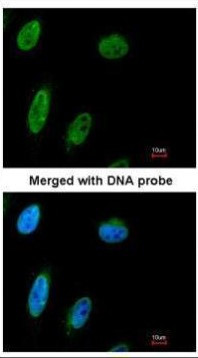 NBS1 Antibody in Immunocytochemistry (ICC/IF)