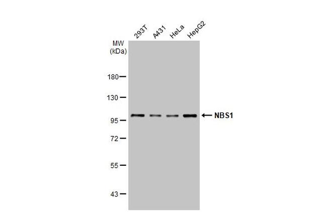 NBS1 Antibody in Western Blot (WB)