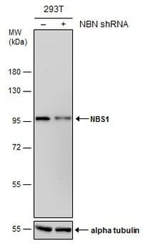 NBS1 Antibody